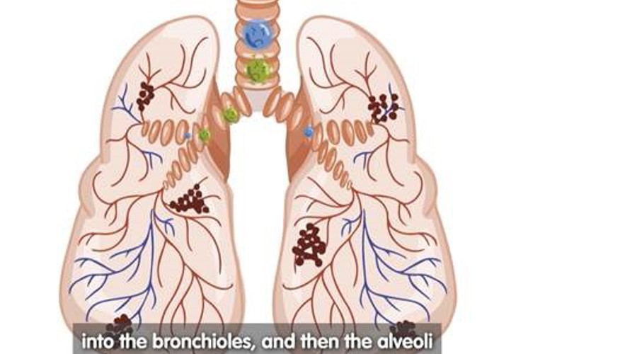 Bronchioles